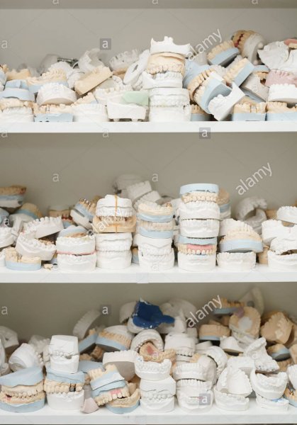 piles-of-dentures-on-several-shelves-close-up-shot-JGDMAP.jpg